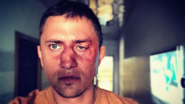 Калининградская полиция занялась инцидентом с избиением Прилучного